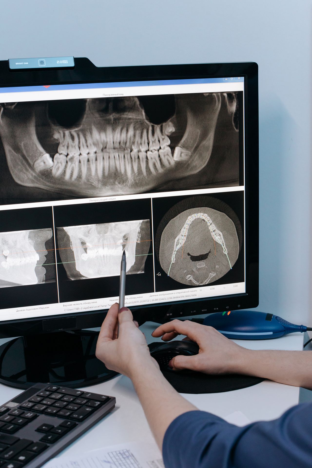 Dental Monitoring